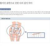 약손약발체형교정원