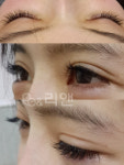 리앤