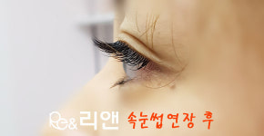 리앤