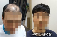 백작맞춤가발 | 이미지 맞춤가발