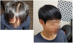 백작맞춤가발 | 이미지 맞춤가발