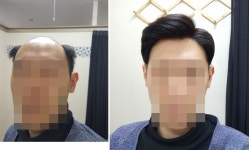 백작맞춤가발 | 이미지 맞춤가발