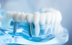 화이트 치과 기공소