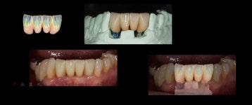 화이트 치과 기공소