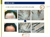 모셀두피항노화센터