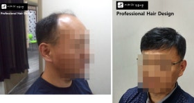 백작맞춤가발 | 이미지 맞춤가발