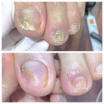 레푸스 선릉점 인디고네일