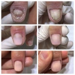 레푸스 선릉점 인디고네일