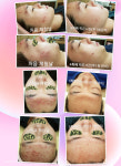 뷰티스토리