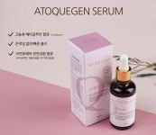 휴에코