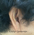 포낙보청기 송파방이센터
