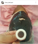 라임스킨케어