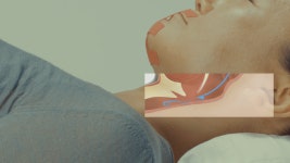 뉴턴1665