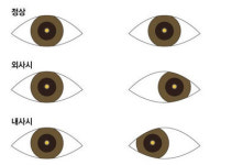 신촌하드렌즈샵안경원