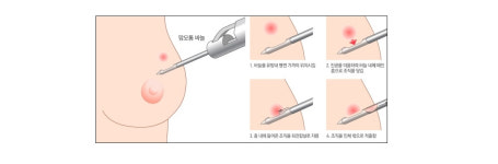 부평하루여성외과의원