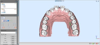 클리어스마일치과기공소
