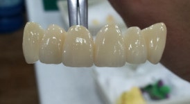 이복치과기공소