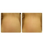 라쉼뷰티테라피