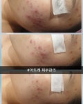 아뜨레