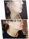 에코메디스킨케어