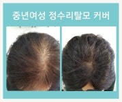 김호증모가발 끌리모헤어