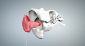 청각학박사 김도균보청기