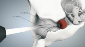 청각학박사 김도균보청기