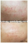 서은메디스킨케어