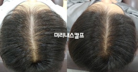 미리내스칼프 평택점