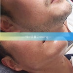 뽑고왁싱