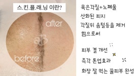 여우스킨앤바디