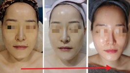 디모 풋 앤 바디