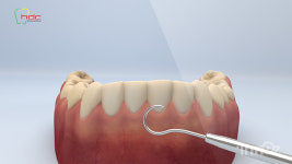 에이지글로벌스
