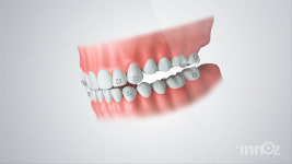 에이지글로벌스