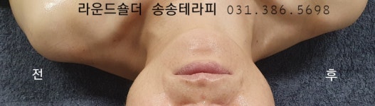 송송테라피