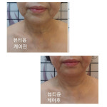 윤권희 피부관리소 | 윤권희 피부연구소