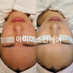 아이미스킨케어