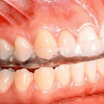 드라큘라치과의원