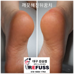레푸스감삼점&에이레네