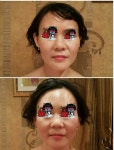 구해진피부사랑