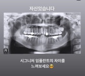 서울금플란트치과의원 은평