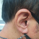 프리미엄보청기 계양센터