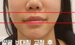 본연애스킨 성북점 | 본연애스킨 김포점