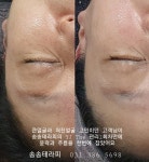 송송테라피