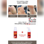레푸스 경대점