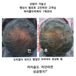 송송테라피