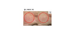 고민정피부관리실