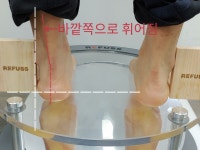 레푸스 경대점