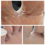 레푸스 경대점