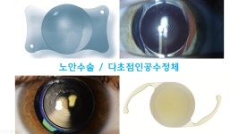 거창제일안과의원